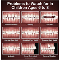 5 Reasons To Start Orthodontic Therapy Early Rather Than Late